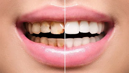 Clínica Dental Smile